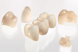 磯子区杉田・くすのき歯科クリニック・セラミック製の修復物を低コスト・短時間で提供