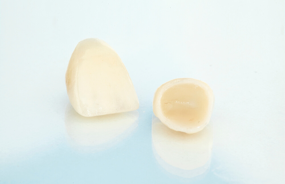 磯子区杉田・くすのき歯科クリニック・天然の歯を残すためのメタル・フリー